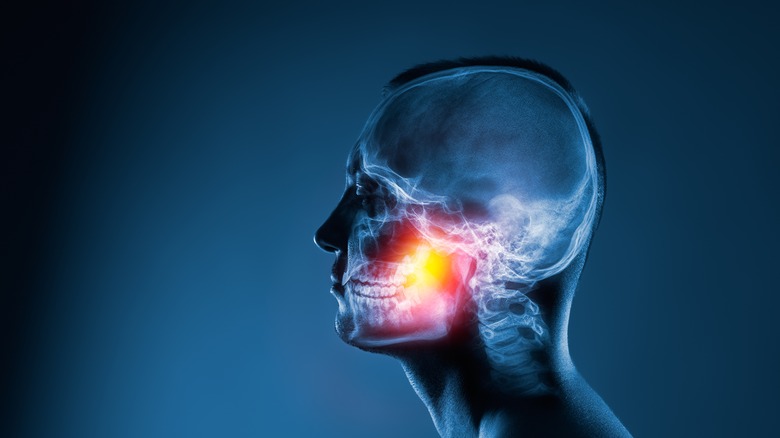 x-ray skull with jaw highlighted