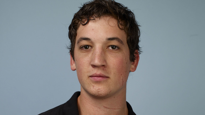 Scars on young Miles Teller's face