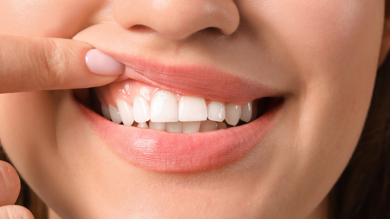 A woman with healthy gums