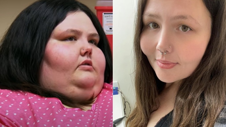 Christina Phillips before and after