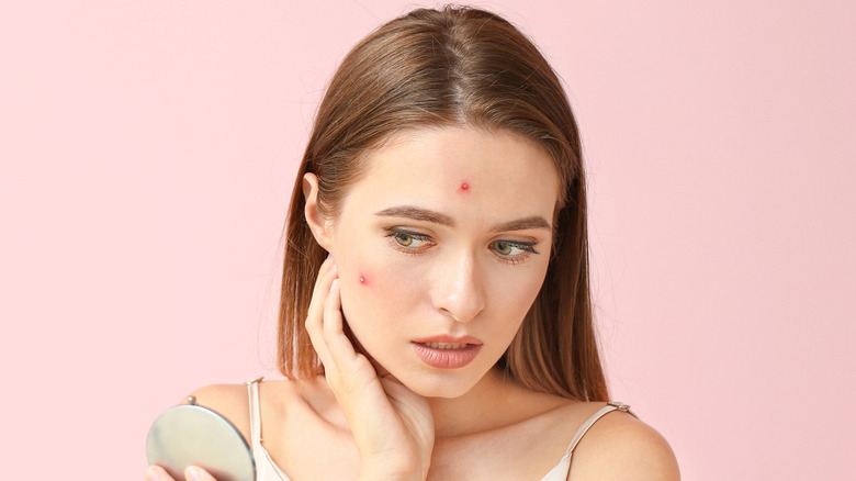 Woman with acne