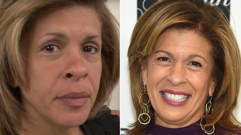 Hoda Kotb without and with makeup