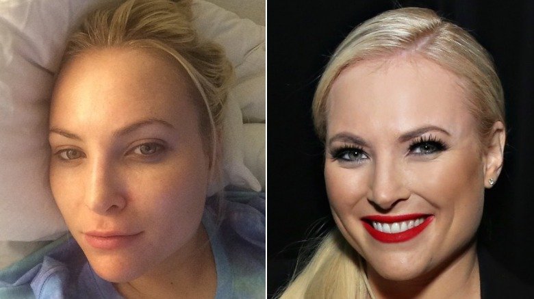 Meghan McCain without and with makeup