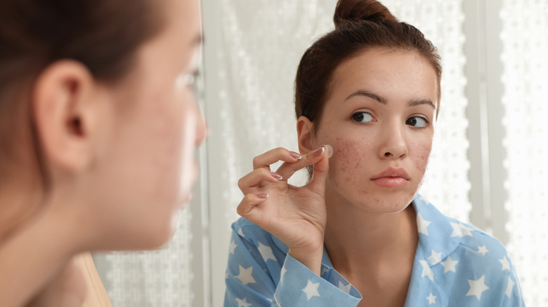 Woman putting on pimple patch