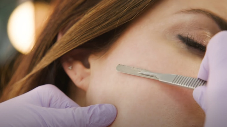 Woman getting dermaplaned