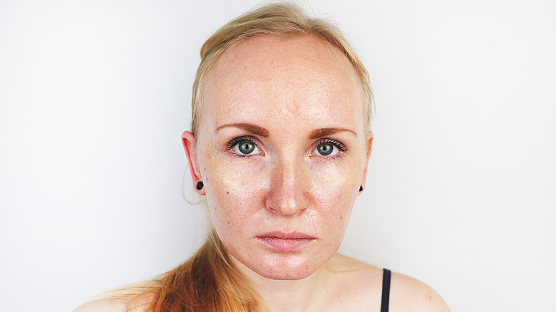 Woman with oily skin