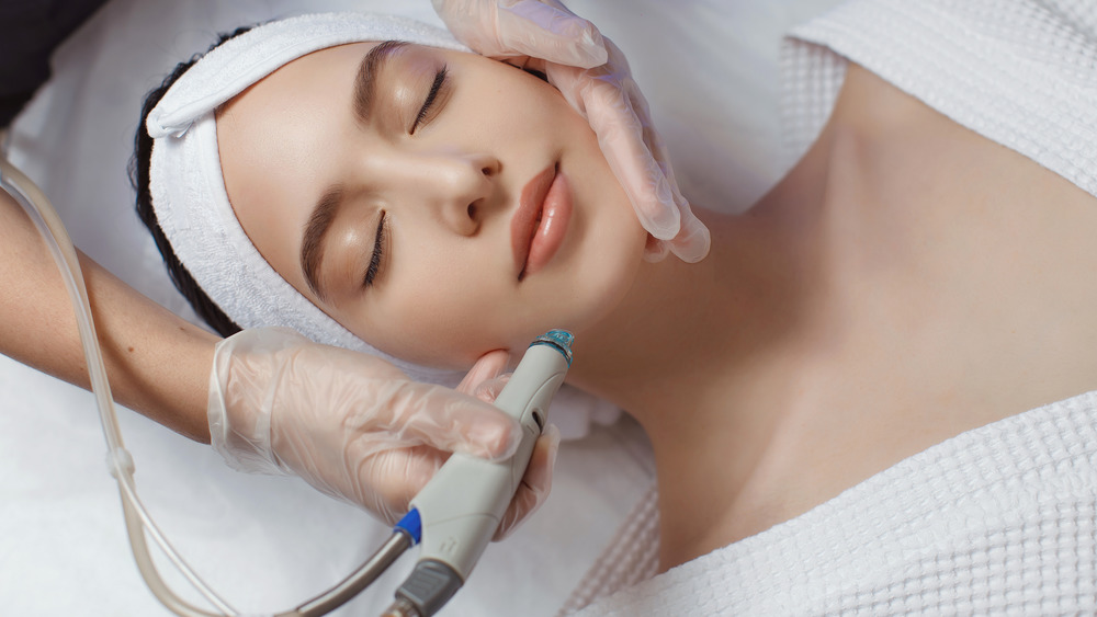 facial laser treatment