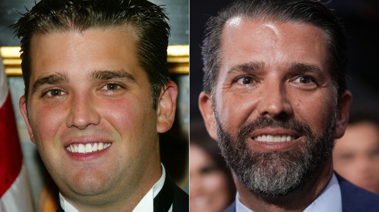 A comparison of Donald Trump Jr.'s teeth before he had cosmetic dental work done