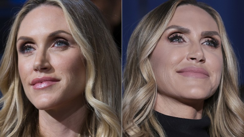 A comparison of Lara Trump before and after surgery