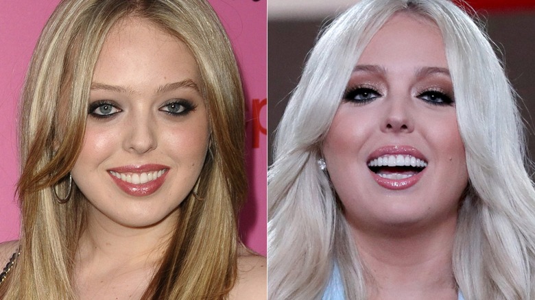 A comparison of Tiffany Trump before and after plastic surgery