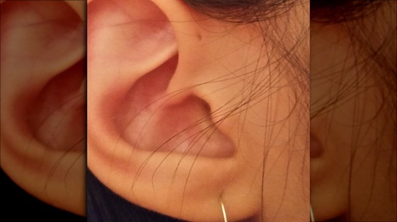 rare body feature preauricular pit