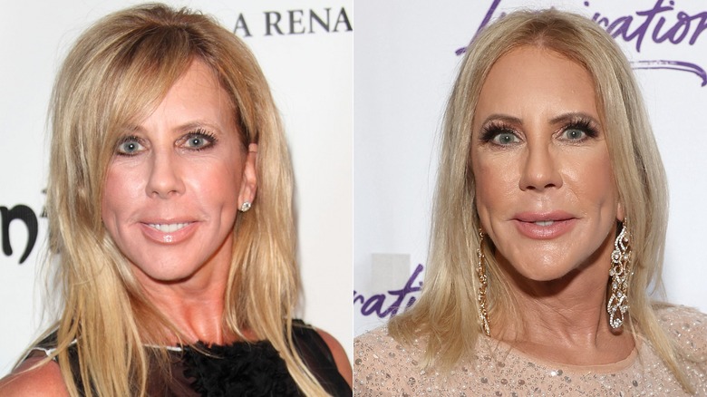 A split image of Vicki Gunvalson 