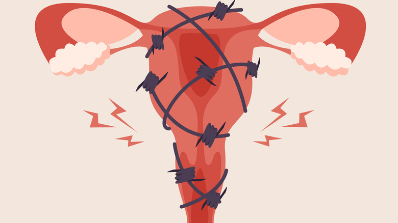 An illustration of a uterus with barbed wire to signify pain and injury.