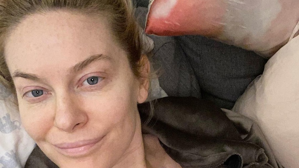 Leah McSweeney poses after her surgery on Instagram