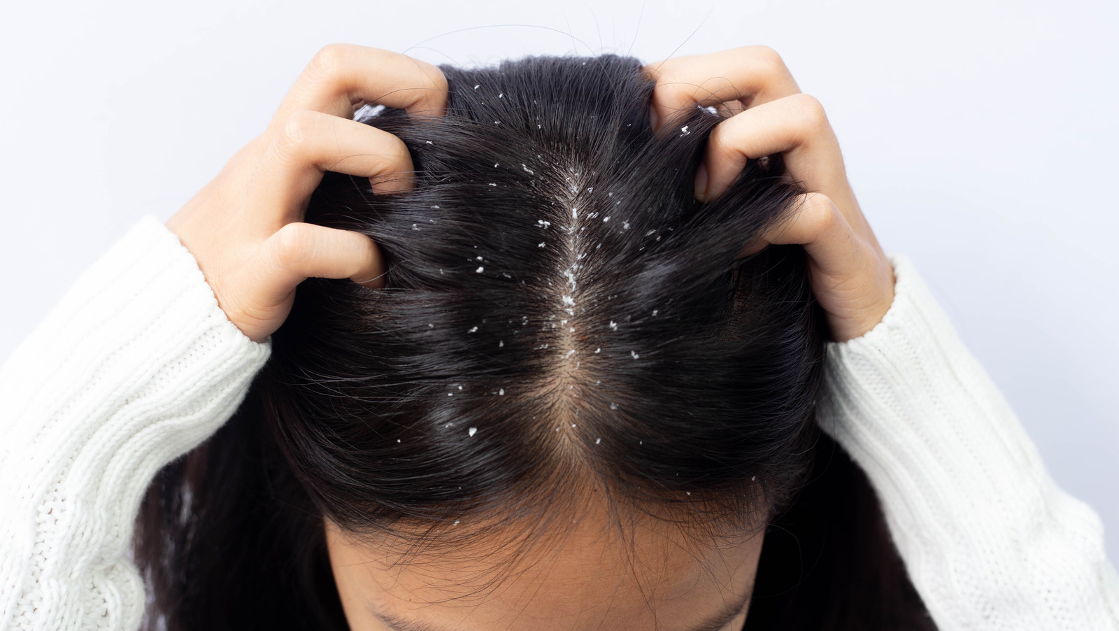 Scalp Problems Castor Oil Can Actually Help With