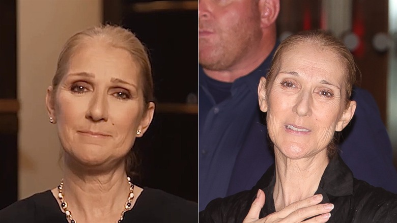 Celine Dion before and after