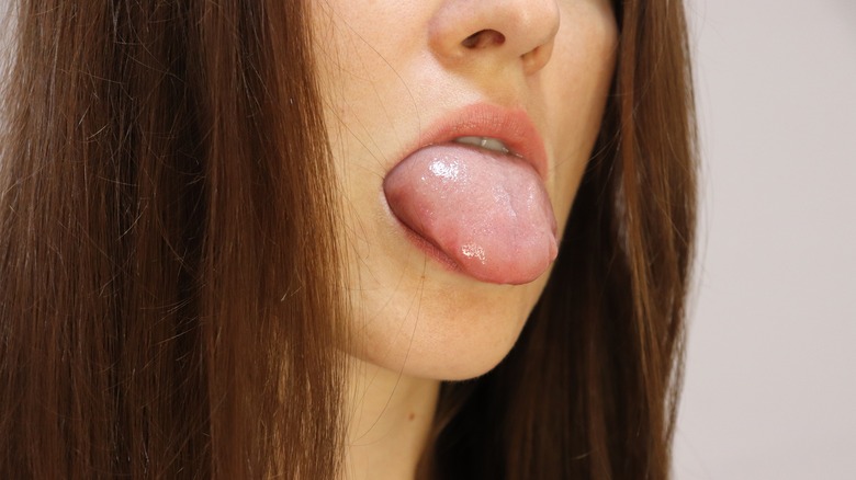 swollen tongue