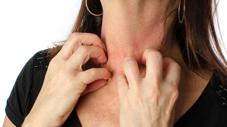 Woman scratching neck