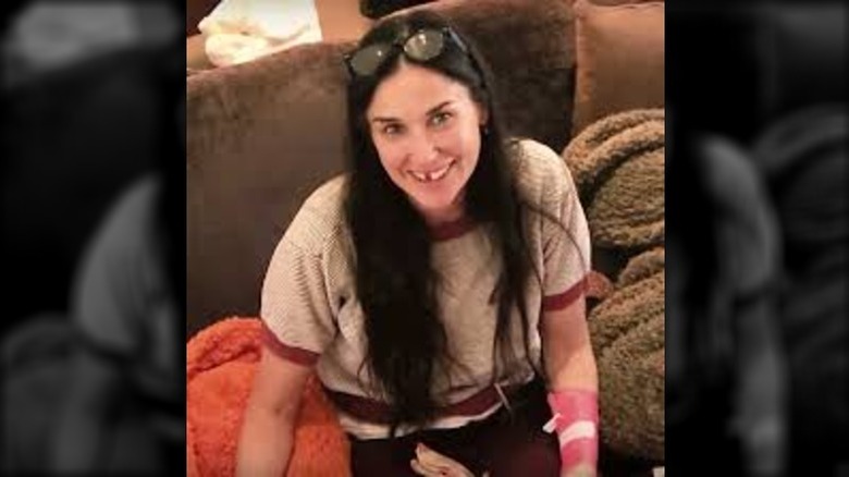 Demi Moore missing front tooth