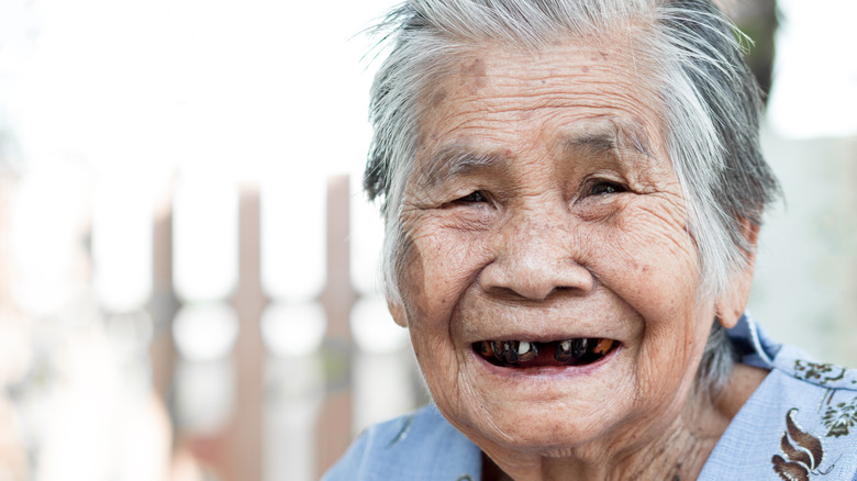 Woman with black teeth