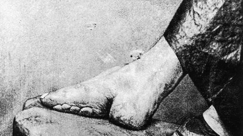 Foot binding