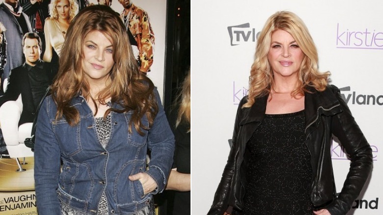 Kirstie Alley before and after body transformation