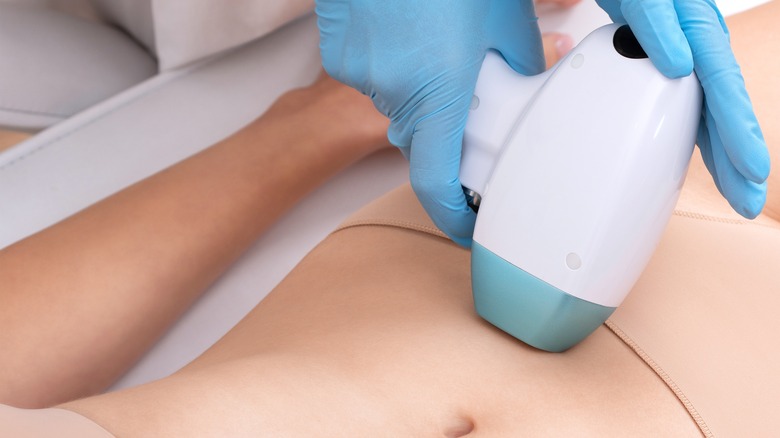 Stomach IPL hair removal