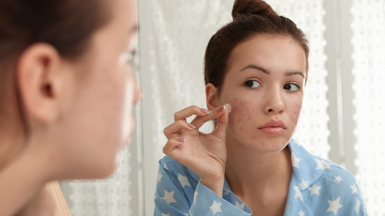 girl applying pimple patch