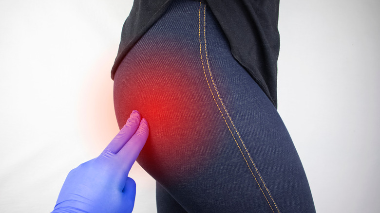 doctor feeling patient's buttock pain