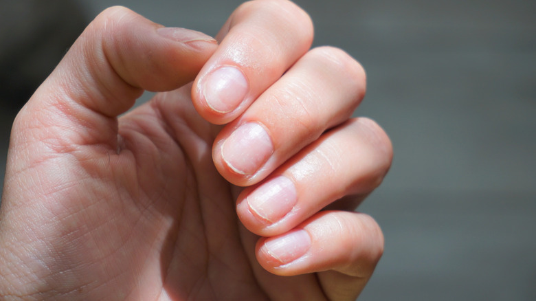 the-biggest-mistakes-everyone-makes-with-gel-nails