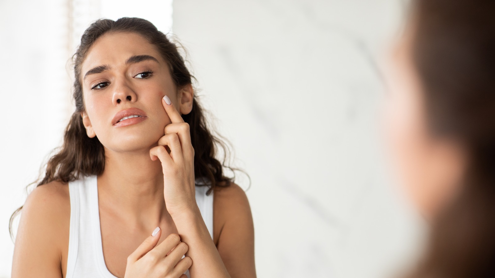 The Difference Between Hormonal Acne And Bacterial Acne And How To 