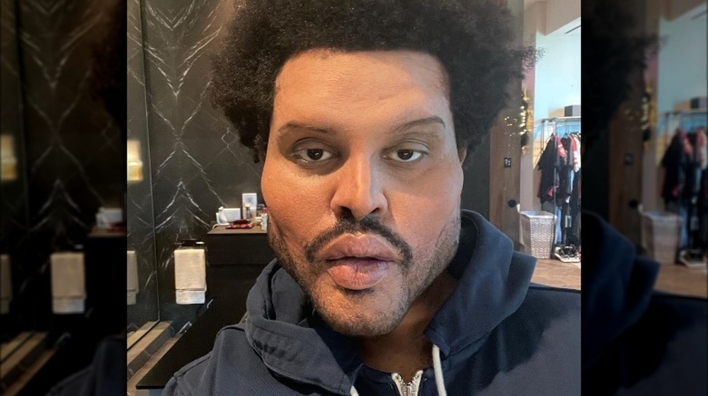 The Weeknd plastic surgery face on Instagram