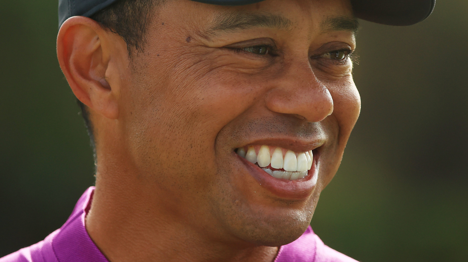 The Extent Of Tiger Woods' Injuries Revealed