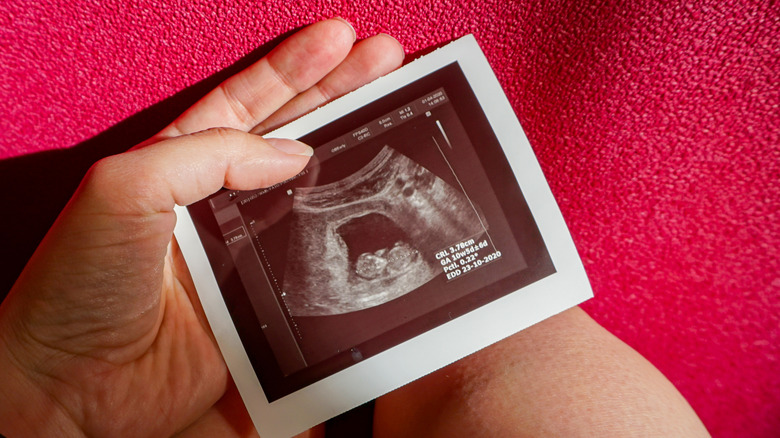 hand holding ultrasound of 10-11 week fetus