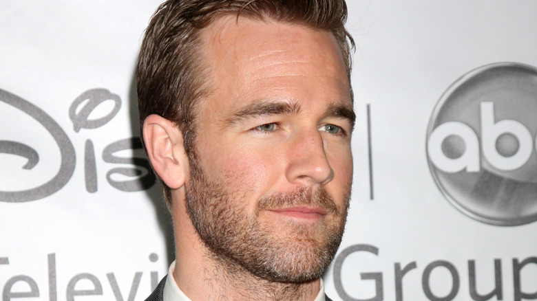 James Van Der Beek smiling with his hair pushed back