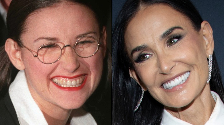 (L) Demi Moore smiling in glasses (R) Demi Moore with ultra-white smile