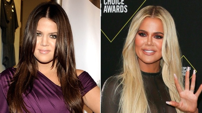 Khloe Kardashian, who underwent a dramatic celebrity transformation
