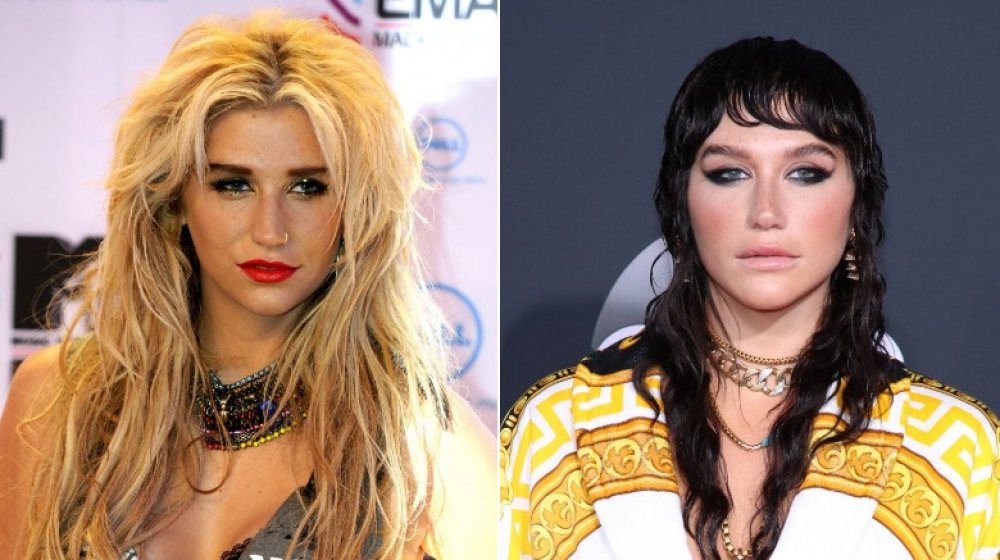 Kesha, who had a stunning transformation in the last decade