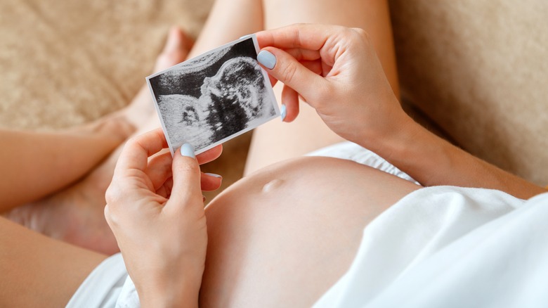 Pregnant woman looking at baby scan
