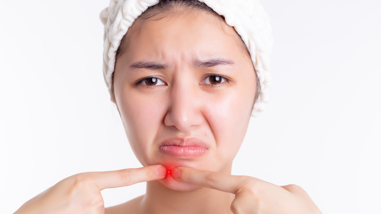 Woman squeezing pimple on chin