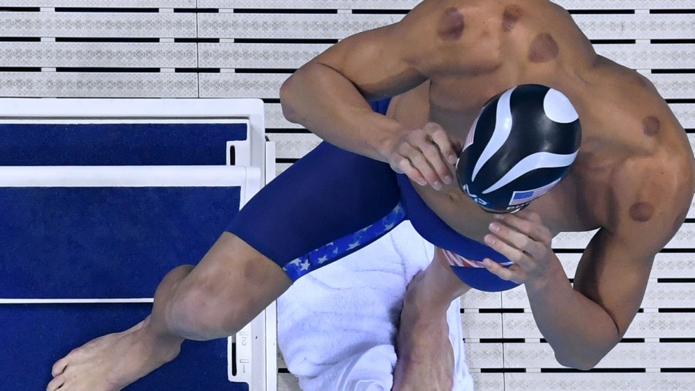 Michael Phelps showing the tell-tale signs of cupping therapy