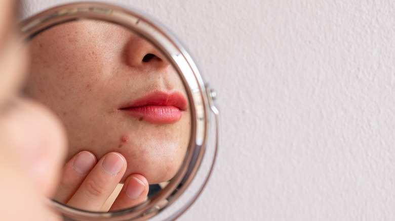 woman looking at pimple in mirror