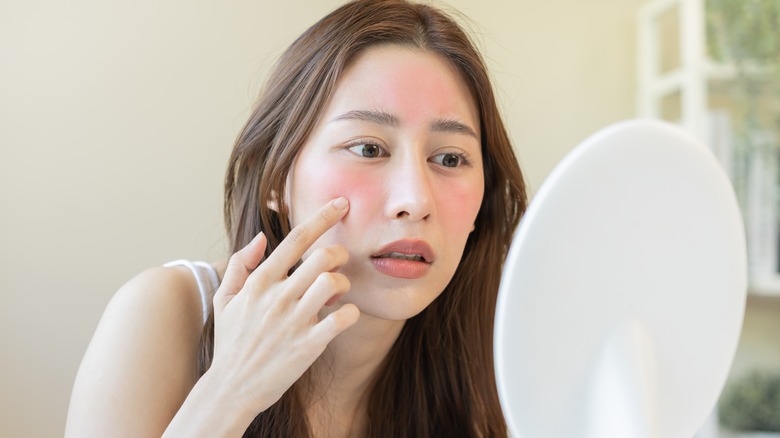 Woman touching sunburn on face