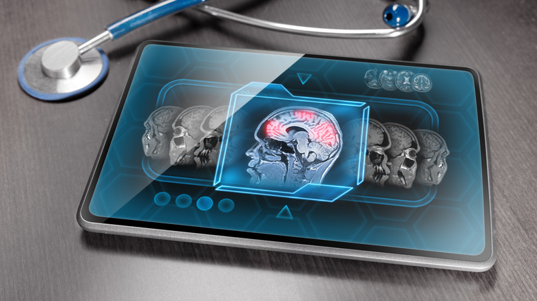 fMRI results on a tablet