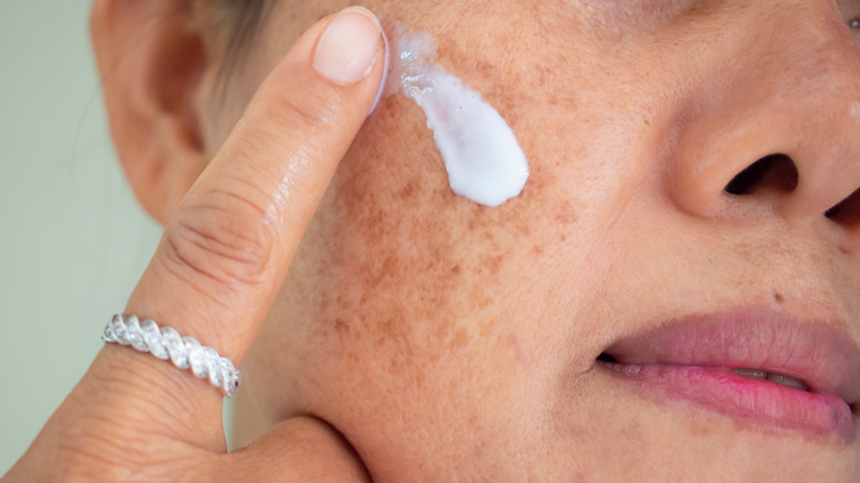 Woman with hyperpigmentation applying face cream