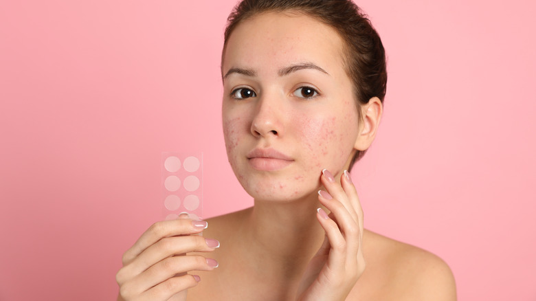 Girl holding acne healing patches