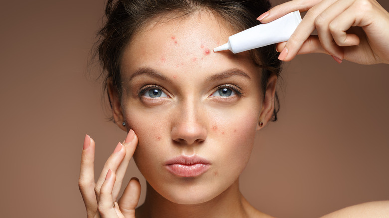 Woman applying treatment to pimples