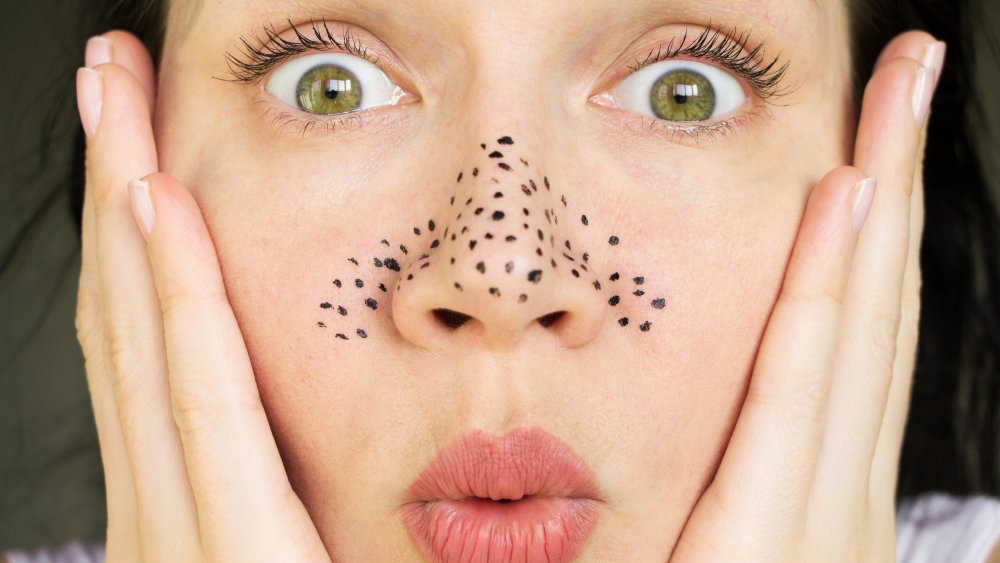 Woman with drawn-on blackheads 