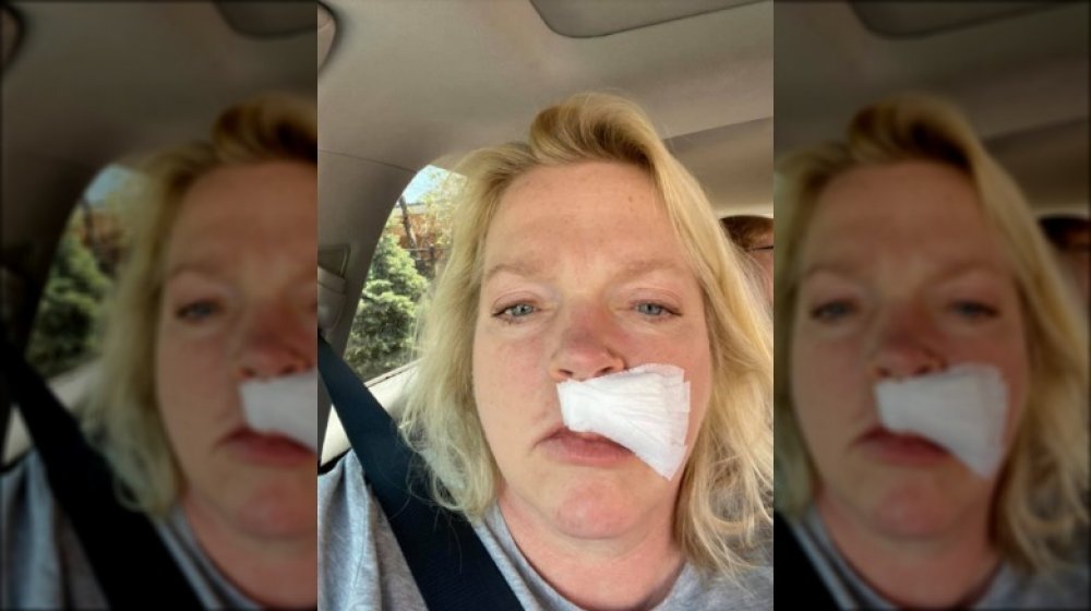 Janelle Brown from Sister Wives with gauze on her face