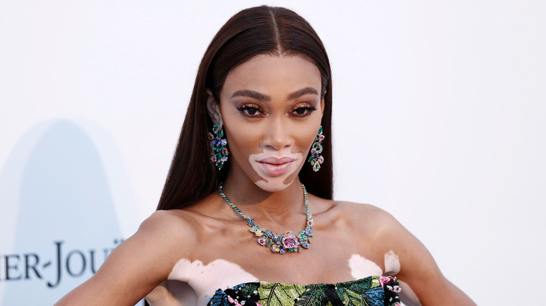 Winnie Harlow poses at a red carpet